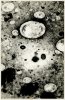 Vírus da varíola
A varíola é uma doença infecto-contagiosa, exclusiva do homem, de surgimento e desenvolvimento repentinos e causada pelo Orthopoxvirus variolae. Foto: Acervo COC.